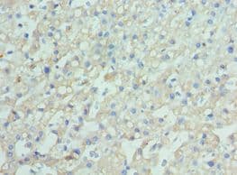 ENPP2 / Autotaxin Antibody (aa564-863)
