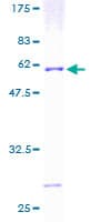 Human ATP6E / ATP6V1E1 Protein (Recombinant GST)