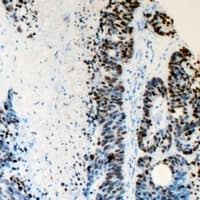 Polyclonal Rabbit anti-Human FANCD2 Antibody (N-Terminus, IHC, WB)