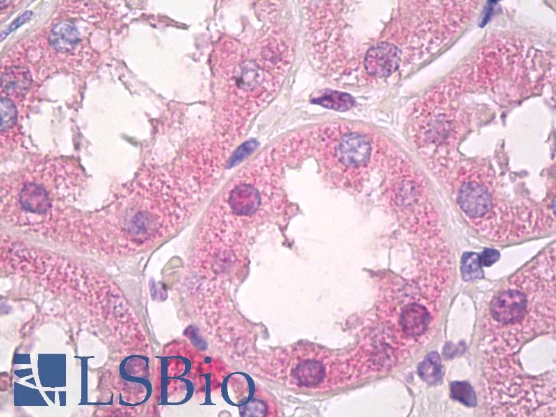 IHC-plus™ PFKP Antibody (aa754-784)