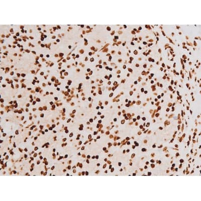 REL / C-Rel Antibody (phospho-Ser503)