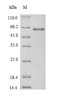 Mouse Alpha-Fetoprotein (Recombinant)
