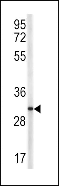 Polyclonal Rabbit anti-Human CD40L Antibody (aa33-62, IHC, IF, WB)