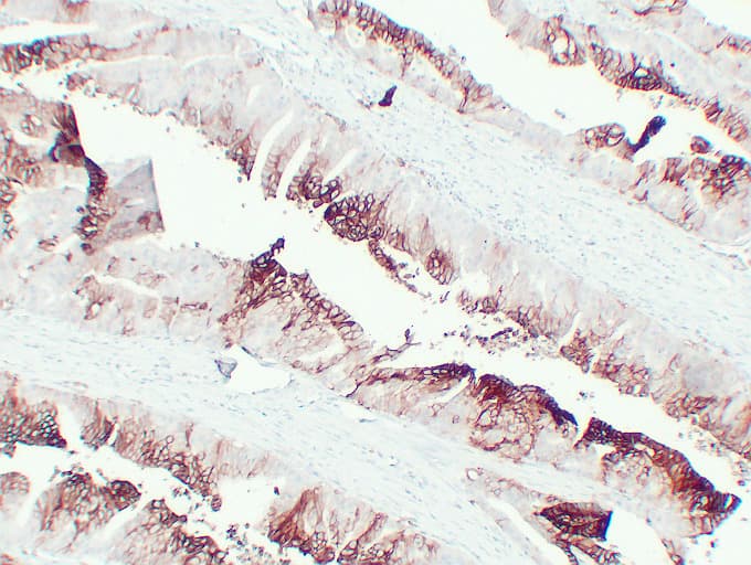 SLC2A1 / GLUT-1 Antibody (clone ABT-GLUT1)