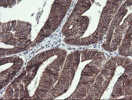 BCL2L1 / BCL-XL Antibody (clone OTI2D1)