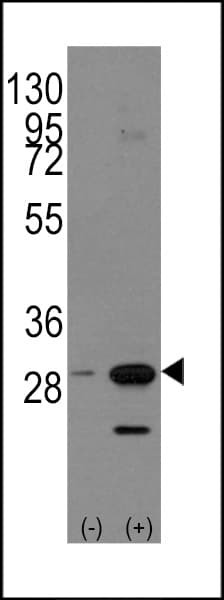 IHC-plus™ Polyclonal Rabbit anti-Human PHB / Prohibitin Antibody (aa182-211, IHC, WB)