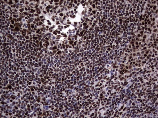DDX56 Antibody (aa323-547, clone UMAB152)