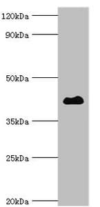 Polyclonal Rabbit anti-Human HDAC8 Antibody (aa1-377, IHC, WB)