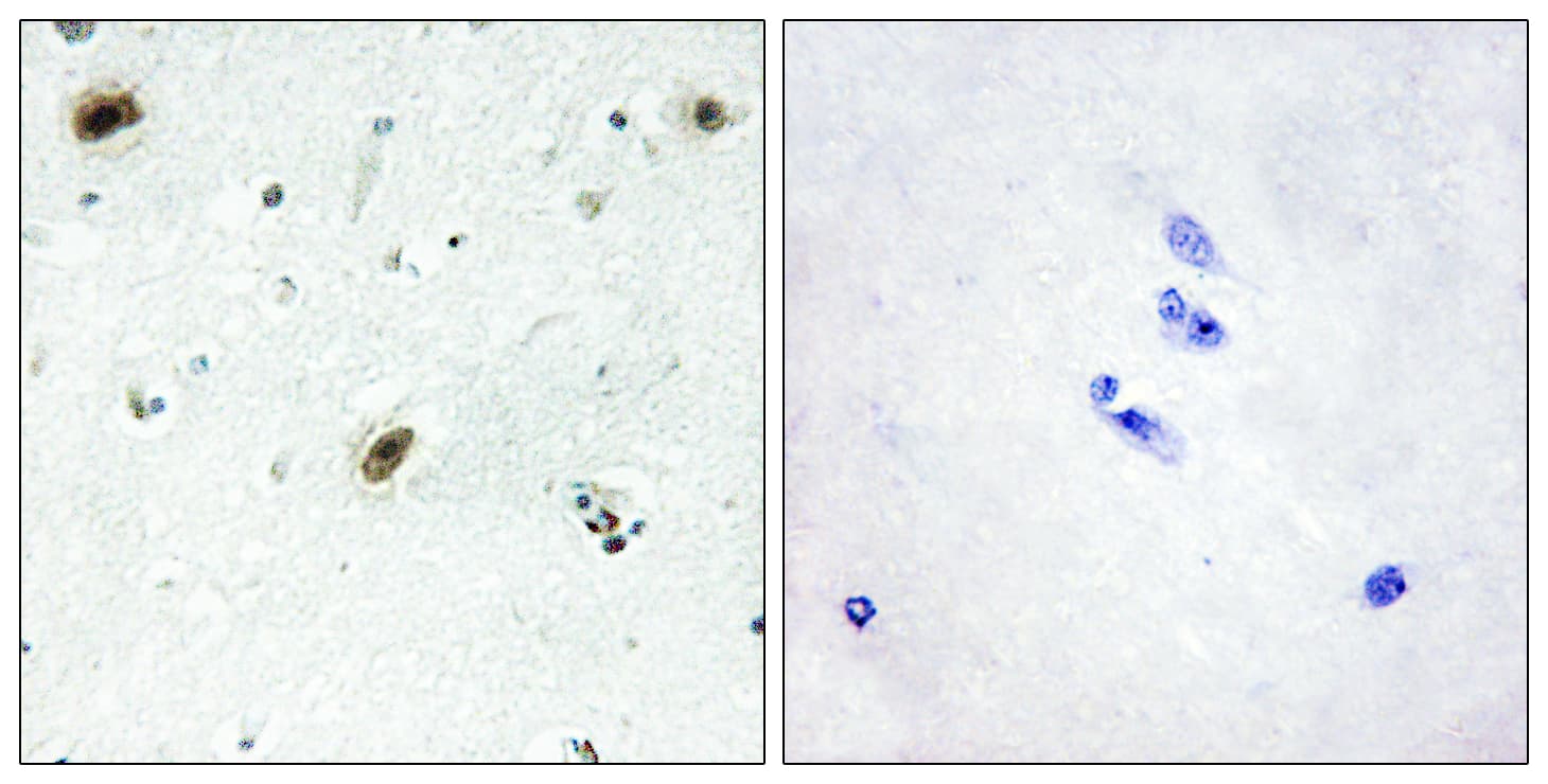 ABL1 / c-ABL Antibody (aa861-910)