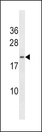 Polyclonal Rabbit anti-Human DHAND / HAND2 Antibody (aa179-207, IHC, WB)
