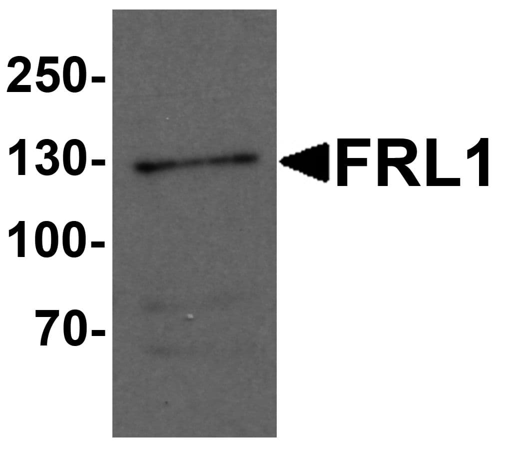 IHC-plus™ FMNL1 Antibody