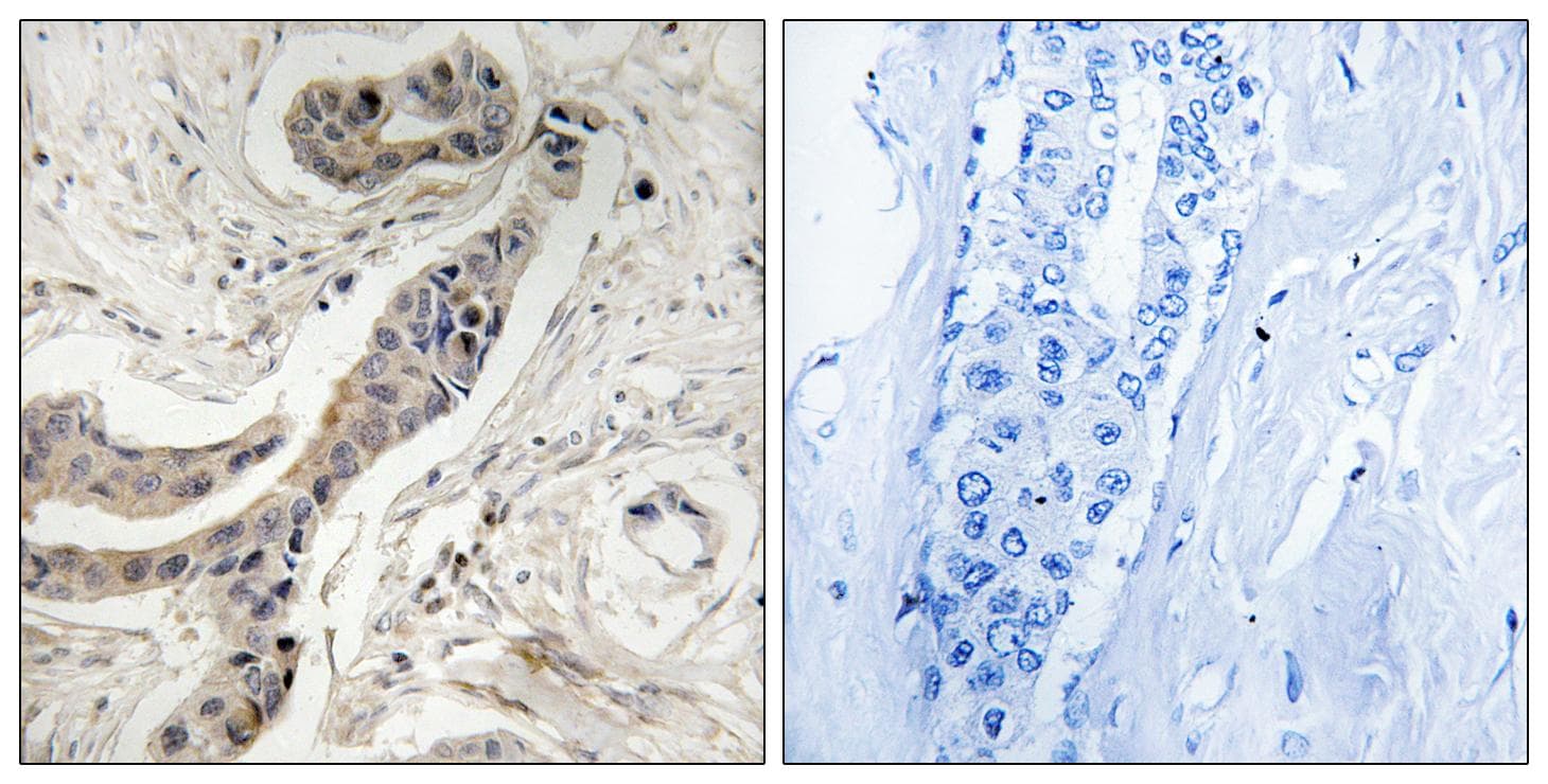 BCL2L1 / BCL-XL Antibody (phospho-Thr115)