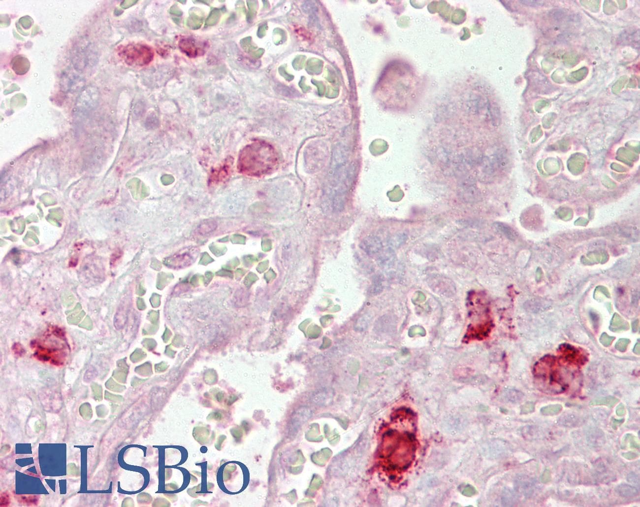 IHC-plus™ AGO1 / EIF2C Antibody (aa382-395)