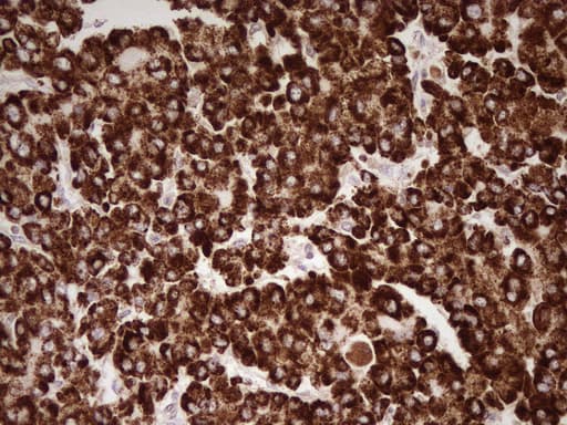 ABAT Antibody (aa29-323, clone UMAB178, Carrier-free)