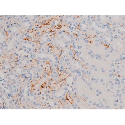 CDC25A Antibody (phospho-Ser75)