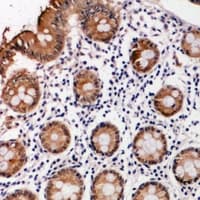 PIK3R5 Antibody