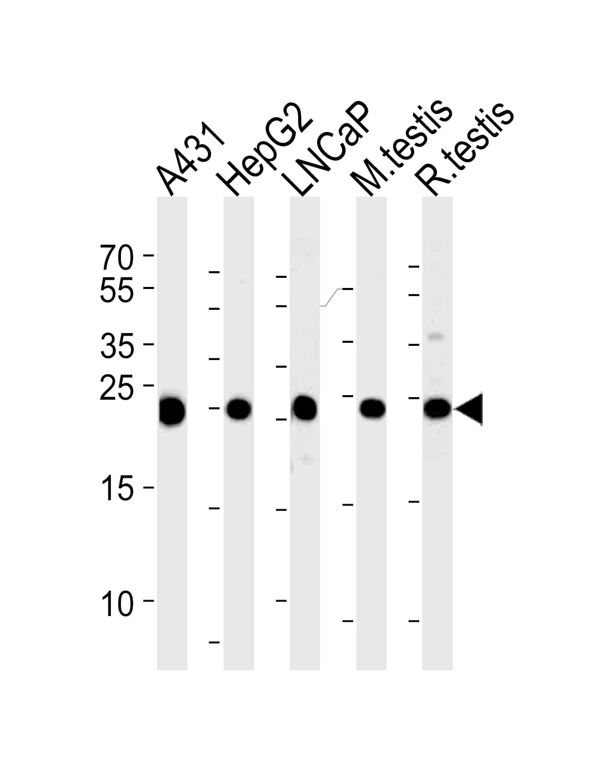 TPI1 / TPI Antibody (aa258-286)