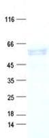 Human AAAS / Adracalin Protein (Recombinant DDK,C-terminus)