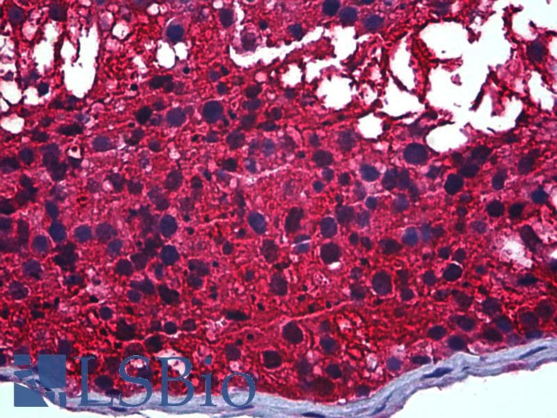 IHC-plus™ CAPZB / CAPZ Beta Antibody (clone 1H1)