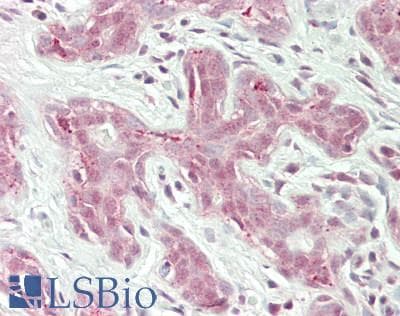 IHC-plus™ Polyclonal Rabbit anti-Human RBM10 Antibody (aa880-C-term, IHC, WB)