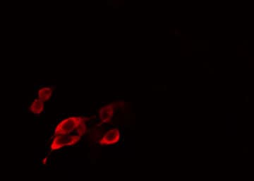 Polyclonal Rabbit anti-Human HELO1 / ELOVL5 Antibody (IHC, IF, WB)