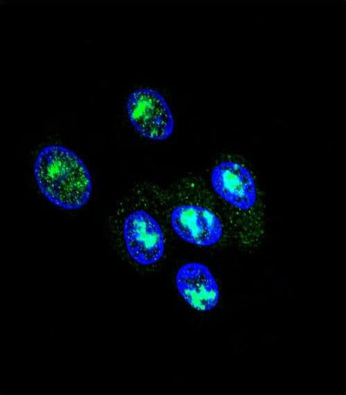 Polyclonal Rabbit anti-Human FOXP2 Antibody (aa657-684, IF, WB)