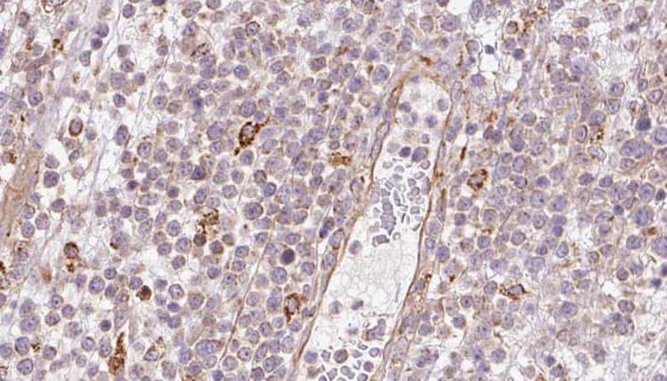 Polyclonal Rabbit anti-Human BBS4 Antibody (IHC, WB)