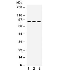 Polyclonal Rabbit anti-Human ABCB2 / TAP1 Antibody (IHC, WB)