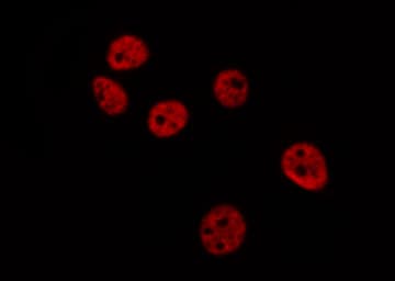 DAXX Antibody