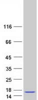 Human GNRH Protein (Recombinant Myc-DDK (Flag))
