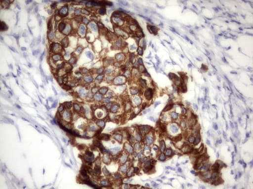 Acidic Cytokeratin Antibody (clone 8F5)