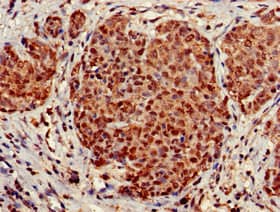STOML3 Antibody