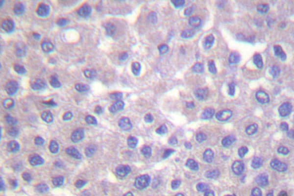 PLCG2 / PLC Gamma 2 Antibody (Arg747)