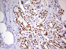 DDX56 Antibody (aa323-547, clone OTI2E5)