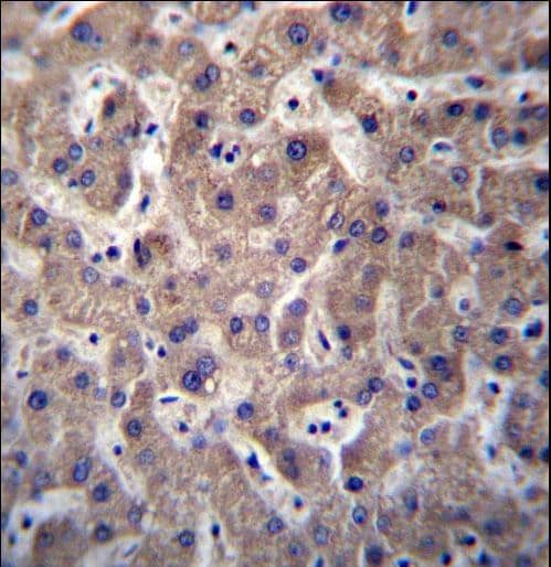 M-PST / STM Antibody (aa71-99)