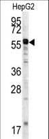 Polyclonal Rabbit anti-Human MMP20 Antibody (aa233-262, IHC, WB)