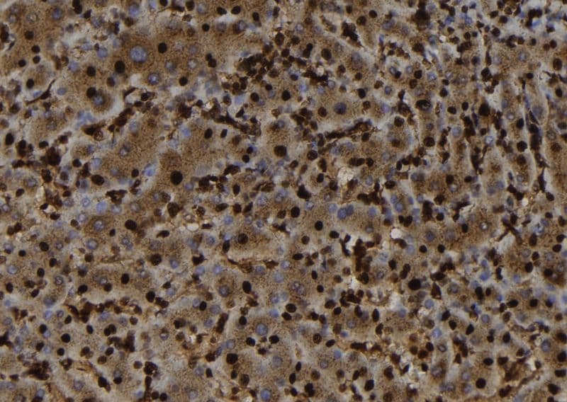 SH3BGRL Antibody