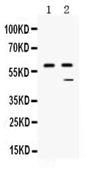 CPB2 / TAFI Antibody