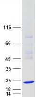 Human HSPB3 Protein (Recombinant Myc-DDK (Flag))