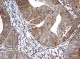 ILVBL Antibody (clone OTI3E9)