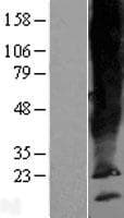 SCAMP5 Protein (Over-Expression Lysate Myc-DDK (Flag))