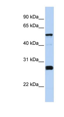 FAM83F Antibody (aa288-337)