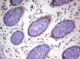 DDX56 Antibody (aa323-547, clone OTI2E5)
