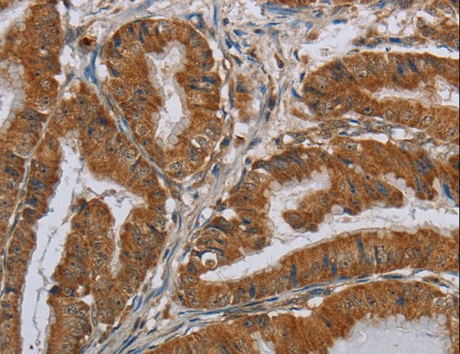 Polyclonal Rabbit anti-Human CSH1 / Placental Lactogen Antibody (IHC, WB)