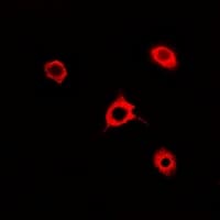 RAC1 Antibody