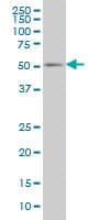 PEPD / PROLIDASE Antibody (clone 1D5-H3)
