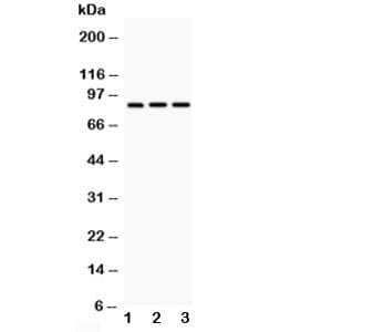 ITGB2 / CD18 Antibody (aa24-54)