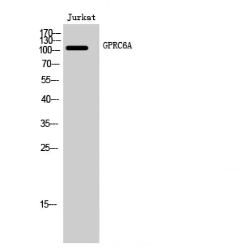 Polyclonal Rabbit anti-Human GPRC6A Antibody (440-520 aa, Internal, IF, WB)