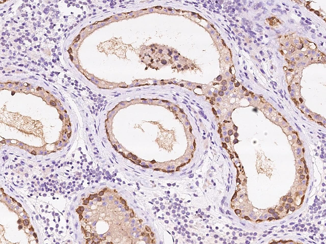Polyclonal Rabbit anti-Human RNH1 Antibody (IHC, IF)