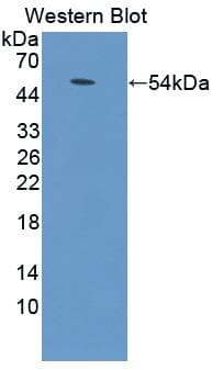ADCY9 / Adenylate Cyclase 9 Antibody (aa852-1065, Cy3)